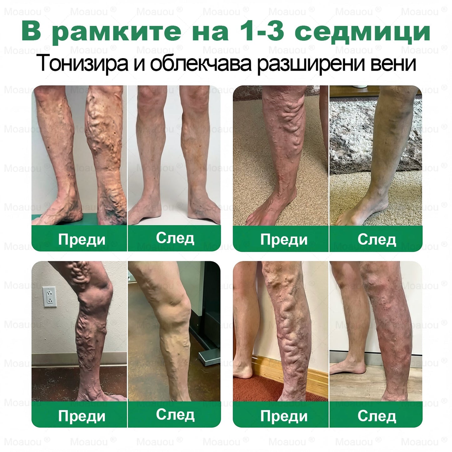 ⏰ Поздравления! Отключихте ексклузивна оферта за Moauou®! Днес получавате допълнителна 50% отстъпка за вашата поръчка. Кликнете върху линка по-долу, за да се възползвате от това специално предложение – офертата изтича скоро! ⏰
