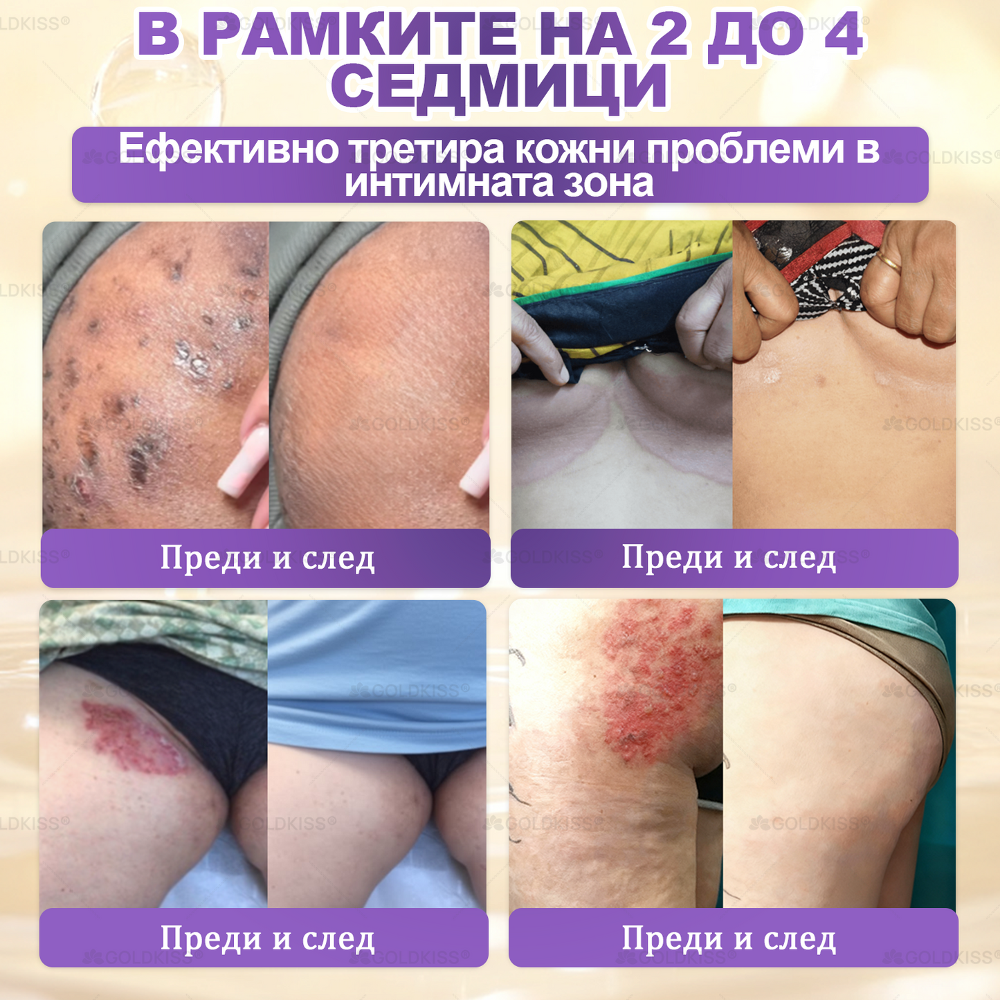 Произведено и изпратено от Европа ✨ 𝐆𝐎𝐋𝐃𝐊𝐈𝐒𝐒® 𝐆𝐇𝐊-𝐂𝐮 & 𝐁𝐈𝐎𝐓𝐈𝐍 𝟏𝟎-𝐁-𝟏 Възстановяващ крем за кожата ⚡
