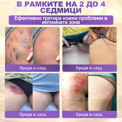 Произведено и изпратено от Европа ✨ 𝐆𝐎𝐋𝐃𝐊𝐈𝐒𝐒® 𝐆𝐇𝐊-𝐂𝐮 & 𝐁𝐈𝐎𝐓𝐈𝐍 𝟏𝟎-𝐁-𝟏 Възстановяващ крем за кожата ⚡