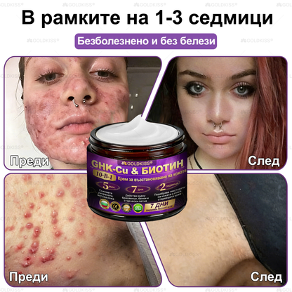 Произведено и изпратено от Европа ✨ 𝐆𝐎𝐋𝐃𝐊𝐈𝐒𝐒® 𝐆𝐇𝐊-𝐂𝐮 & 𝐁𝐈𝐎𝐓𝐈𝐍 𝟏𝟎-𝐁-𝟏 Възстановяващ крем за кожата ⚡