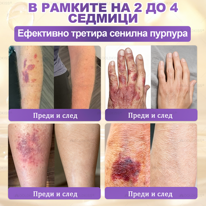 Произведено и изпратено от Европа ✨ 𝐆𝐎𝐋𝐃𝐊𝐈𝐒𝐒® 𝐆𝐇𝐊-𝐂𝐮 & 𝐁𝐈𝐎𝐓𝐈𝐍 𝟏𝟎-𝐁-𝟏 Възстановяващ крем за кожата ⚡