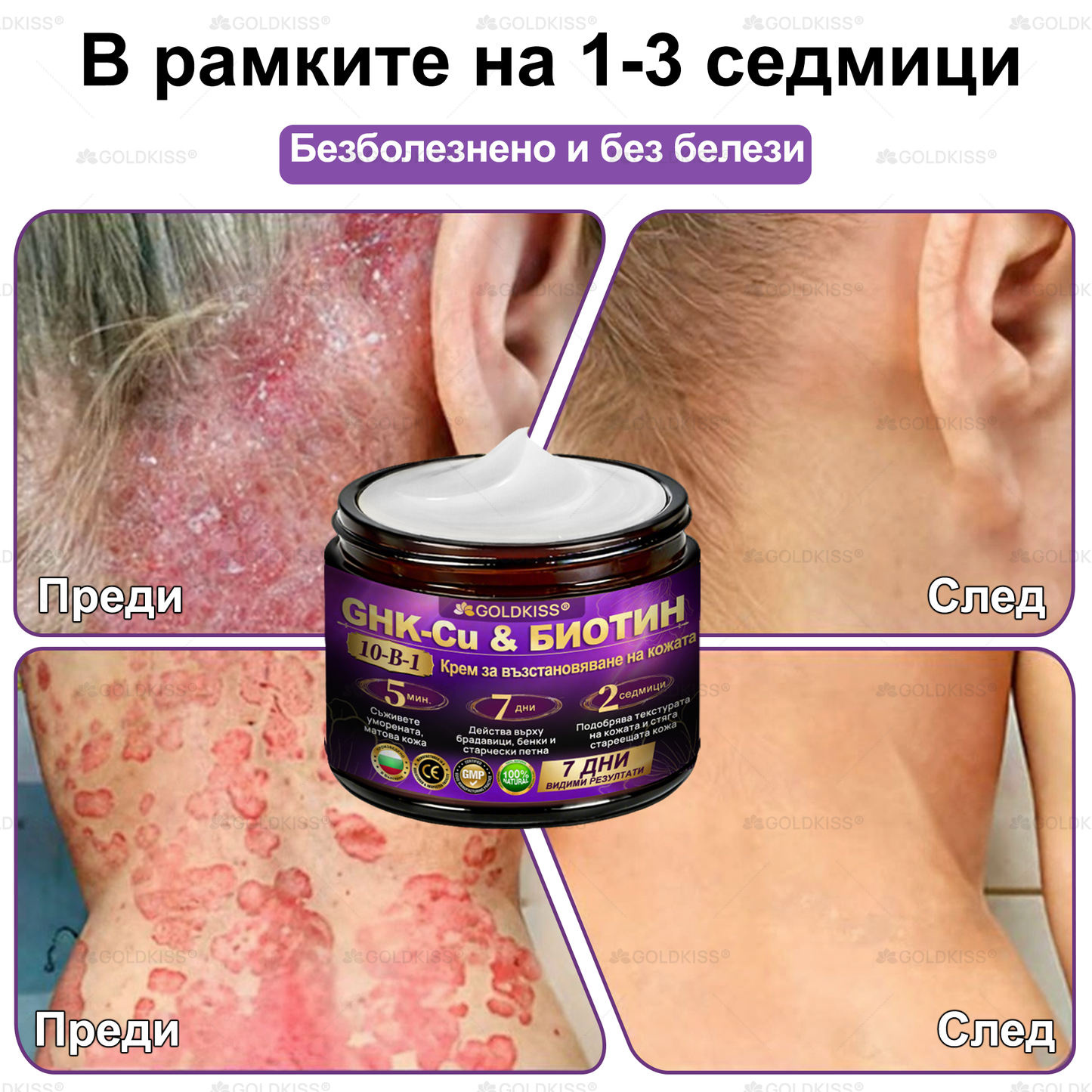 Произведено и изпратено от Европа ✨ 𝐆𝐎𝐋𝐃𝐊𝐈𝐒𝐒® 𝐆𝐇𝐊-𝐂𝐮 & 𝐁𝐈𝐎𝐓𝐈𝐍 𝟏𝟎-𝐁-𝟏 Възстановяващ крем за кожата ⚡