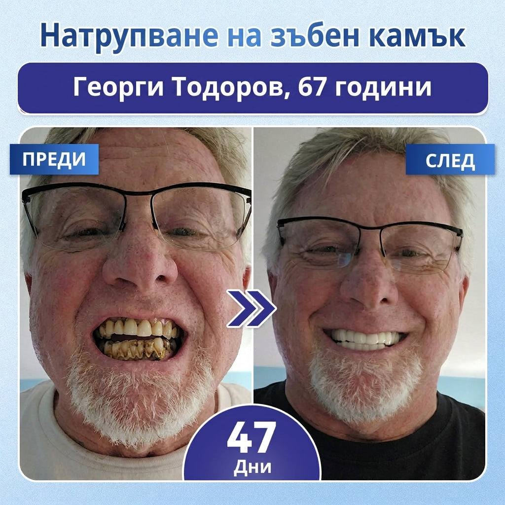 🇧🇬🦷 Кажете сбогом на чувствителността и дискомфорта! 𝐂𝐨𝐚𝐮𝐨𝐨® Tideglusib орални ленти – бързо възстановяване за зъби и венци 😊