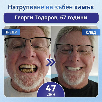 🇧🇬🦷 Кажете сбогом на чувствителността и дискомфорта! 𝐂𝐨𝐚𝐮𝐨𝐨® Tideglusib орални ленти – бързо възстановяване за зъби и венци 😊