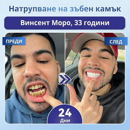 🇧🇬🦷 Кажете сбогом на чувствителността и дискомфорта! 𝐂𝐨𝐚𝐮𝐨𝐨® Tideglusib орални ленти – бързо възстановяване за зъби и венци 😊